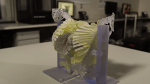 This 3D model helped surgeons at Texas Children's Hospital map out the procedure that successfully separated 10-month-old twin girls
